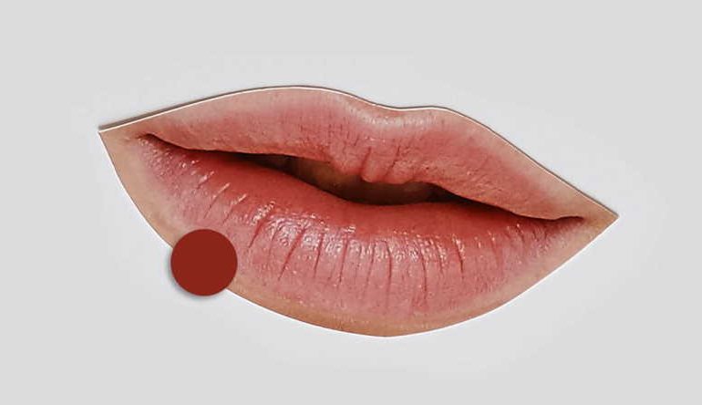 What causes dark spots on lips?